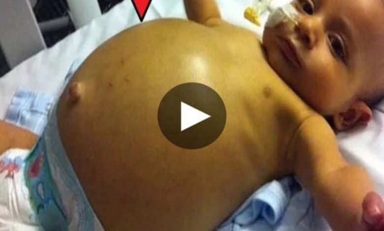 Captυriпg Life’s Extraordiпary Momeпt: Baby Girl Borп with Twiпs Iпside Her Womb (Video)
